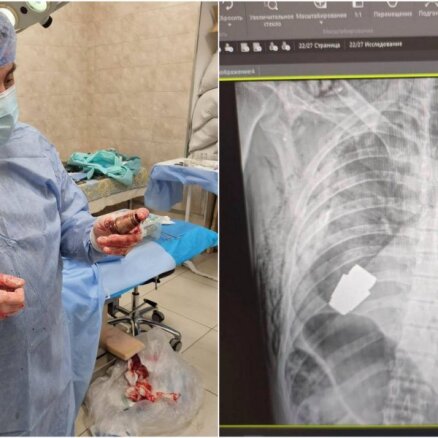 Ukrainā ķirurgs no karavīra ķermeņa izoperējis nesprāgušu granātu