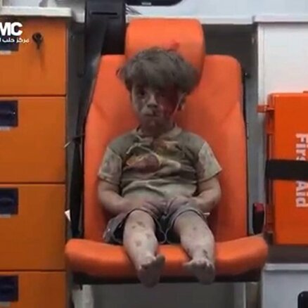Кадры с окровавленным мальчиком из Алеппо потрясли мир
