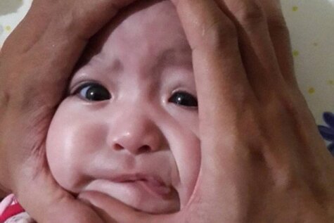 Interneta joks: bērna galvas saspiešana rīsu bumbiņas formā