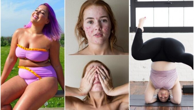 Spītējot skaistuma standartiem. Sešas sievietes 'Instagram' bezbailīgi atklāj savu ķermeni