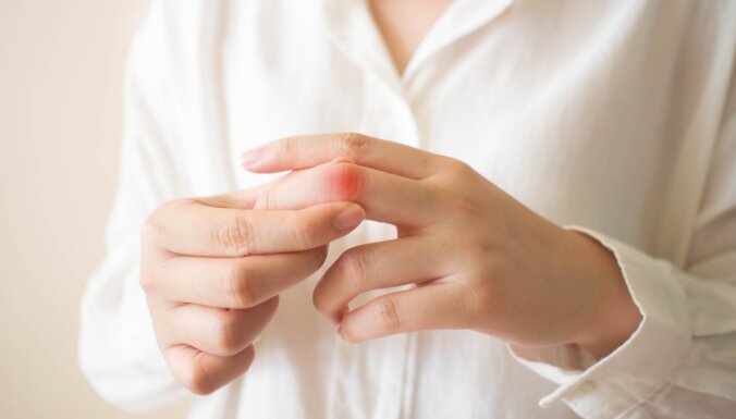 Как по состоянию пальцев можно определить один из самых опасных видов рака