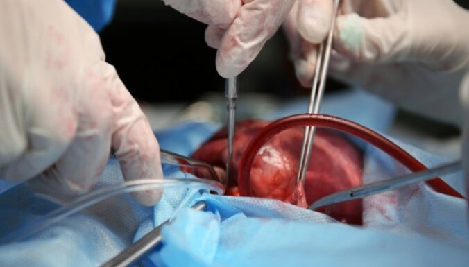 В Латвии успешно проведена первая в этом году трансплантация сердца