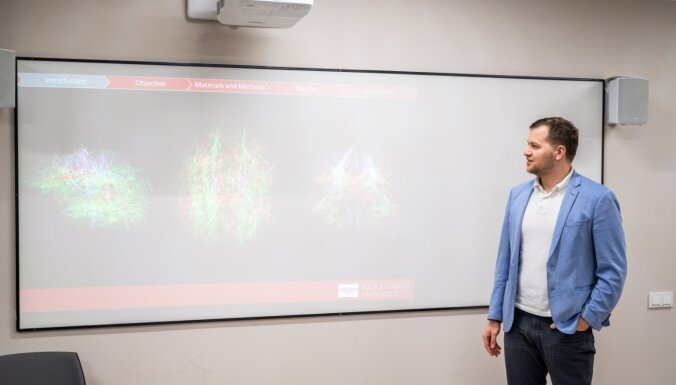 RSU doktorants Nauris Zdanovskis ar modernām tehnoloģijām pēta smadzeņu mikrostruktūru