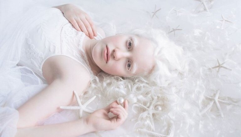 ФОТО: израильский фотограф создала серию портретов людей-альбиносов, и это невероятно красиво