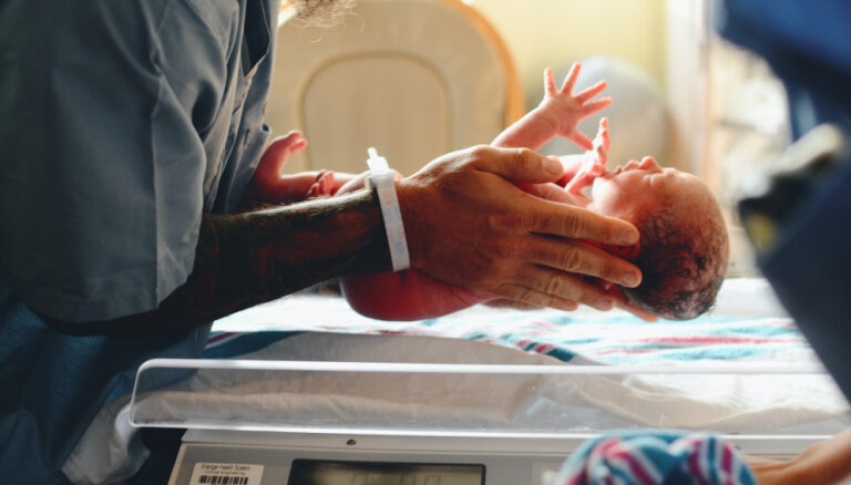 Biežākās dzemdību traumas jaundzimušajiem – atslēgas kaula lūzums un kefalohematomas